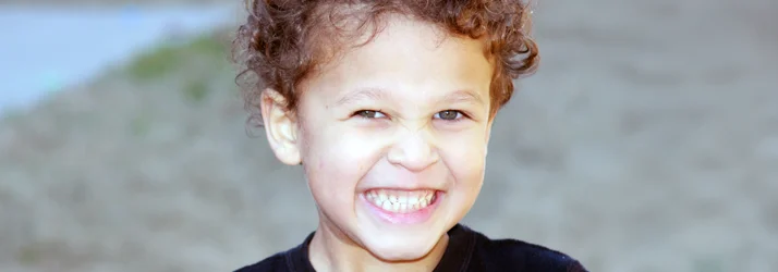 FC – Palate Expander Treatment for Growing Smiles in Madison NJ at Rose City Orthodontics